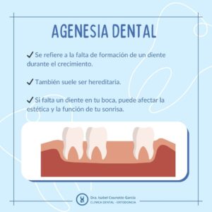 agenesia dental