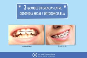 Ortopedia Bucal en niños y adolescentes 3 Diferencias entre ortopedia y ortodoncia